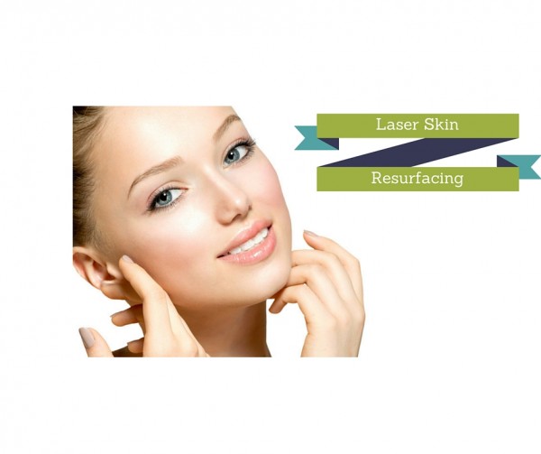 Reasons Why London is the right place for laser skin resurfacing